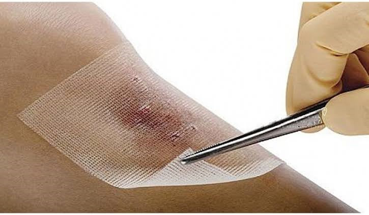 Antimicrobial Dressings: Advanced Wound Care Solutions by Faisal Pharmaceutical Industries